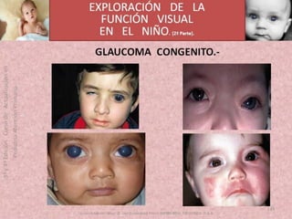 OFTALMOLOGIA BASICA EN PRIMARIA  CURSO