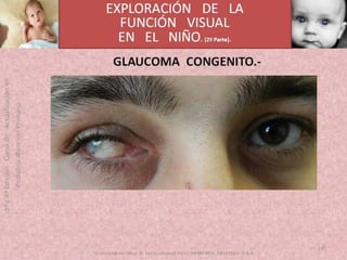 OFTALMOLOGIA BASICA EN PRIMARIA  CURSO