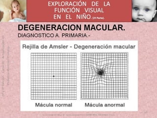 OFTALMOLOGIA BASICA EN PRIMARIA  CURSO