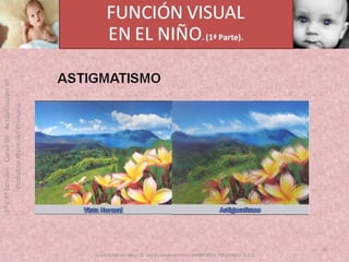 OFTALMOLOGIA BASICA EN PRIMARIA  CURSO