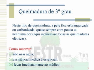 79
Queimadura de 3º grau
Neste tipo de queimadura, a pele fica esbranquiçada
ou carbonizada, quase sempre com pouca ou
nenhuma dor (aqui incluem-se todas as queimaduras
elétricas).
Como socorrer:
não usar água;
assistência médica é essencial;
 levar imediatamente ao médico.
 