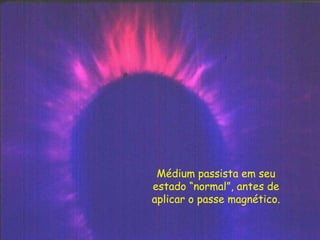 Médium passista em seu
estado “normal”, antes de
aplicar o passe magnético.
 