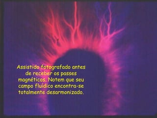 Assistido fotografado antes
de receber os passes
magnéticos. Notem que seu
campo fluídico encontra-se
totalmente desarmonizado.
 