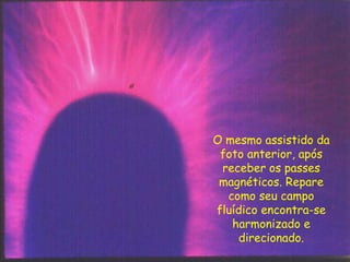 O mesmo assistido da
foto anterior, após
receber os passes
magnéticos. Repare
como seu campo
fluídico encontra-se
harmonizado e
direcionado.
 