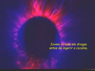 Jovem viciado em drogas
antes de ingerir a cocaína.
 
