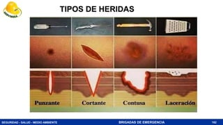 SEGURIDAD - SALUD - MEDIO AMBIENTE BRIGADAS DE EMERGENCIA
TIPOS DE HERIDAS
182
 