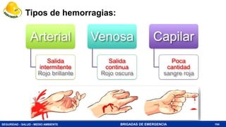 SEGURIDAD - SALUD - MEDIO AMBIENTE BRIGADAS DE EMERGENCIA
Tipos de hemorragias:
194
 
