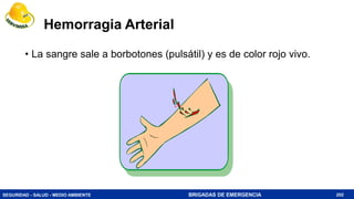 SEGURIDAD - SALUD - MEDIO AMBIENTE BRIGADAS DE EMERGENCIA
Hemorragia Arterial
• La sangre sale a borbotones (pulsátil) y es de color rojo vivo.
202
 