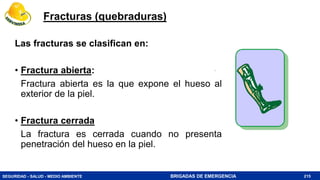 SEGURIDAD - SALUD - MEDIO AMBIENTE BRIGADAS DE EMERGENCIA
Fracturas (quebraduras)
Las fracturas se clasifican en:
• Fractura abierta:
Fractura abierta es la que expone el hueso al
exterior de la piel.
• Fractura cerrada
La fractura es cerrada cuando no presenta
penetración del hueso en la piel.
215
 