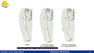 SEGURIDAD - SALUD - MEDIO AMBIENTE BRIGADAS DE EMERGENCIA 217
 