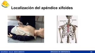 SEGURIDAD - SALUD - MEDIO AMBIENTE BRIGADAS DE EMERGENCIA
Localización del apéndice xifoides
248
 