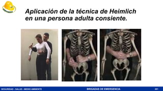 SEGURIDAD - SALUD - MEDIO AMBIENTE BRIGADAS DE EMERGENCIA
Aplicación de la técnica de Heimlich
en una persona adulta consiente.
261
 
