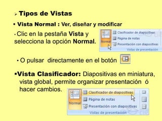 Los Botones de vistas