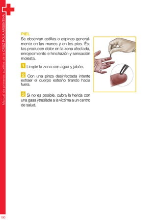 ManualdeprimerosauxiliosdelaCRUZROJAARGENTINA
100
PIEL
Se observan astillas o espinas general-
mente en las manos y en los pies. És-
tas producen dolor en la zona afectada,
enrojecimiento e hinchazón y sensación
molesta.
1 Limpie la zona con agua y jabón.
2 Con una pinza desinfectada intente
extraer el cuerpo extraño tirando hacia
fuera.
3 Si no es posible, cubra la herida con
una gasa ytraslade a la víctima a un centro
de salud.
 