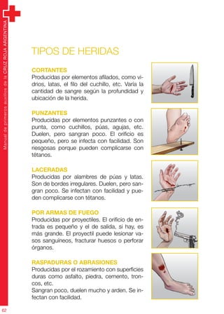 ManualdeprimerosauxiliosdelaCRUZROJAARGENTINA
62
ManualdeprimerosauxiliosdelaCRUZROJAARGENTINA
62
Tipos de heridas
Cortantes
Producidas por elementos afilados, como vi-
drios, latas, el filo del cuchillo, etc. Varía la
cantidad de sangre según la profundidad y
ubicación de la herida.
Punzantes
Producidas por elementos punzantes o con
punta, como cuchillos, púas, agujas, etc.
Duelen, pero sangran poco. El orificio es
pequeño, pero se infecta con facilidad. Son
riesgosas porque pueden complicarse con
tétanos.
Laceradas
Producidas por alambres de púas y latas.
Son de bordes irregulares. Duelen, pero san-
gran poco. Se infectan con facilidad y pue-
den complicarse con tétanos.
Por armas de fuego
Producidas por proyectiles. El orificio de en-
trada es pequeño y el de salida, si hay, es
más grande. El proyectil puede lesionar va-
sos sanguíneos, fracturar huesos o perforar
órganos.
Raspaduras o abrasiones
Producidas por el rozamiento con superficies
duras como asfalto, piedra, cemento, tron-
cos, etc.
Sangran poco, duelen mucho y arden. Se in-
fectan con facilidad.
 