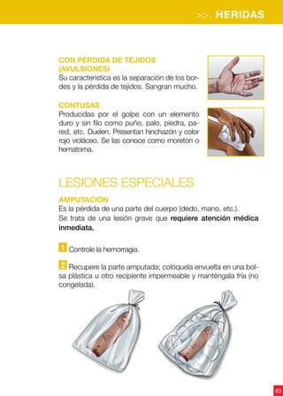 >>. HERIDAS
63
Con pérdida de tejidos
(avulsiones)
Su característica es la separación de los bor-
des y la pérdida de tejidos. Sangran mucho.
Contusas
Producidas por el golpe con un elemento
duro y sin filo como puño, palo, piedra, pa-
red, etc. Duelen. Presentan hinchazón y color
rojo violáceo. Se las conoce como moretón o
hematoma.
Lesiones especiales
Amputación
Es la pérdida de una parte del cuerpo (dedo, mano, etc.).
Se trata de una lesión grave que requiere atención médica
inmediata.
1 Controle la hemorragia.
2 Recupere la parte amputada; colóquela envuelta en una bol-
sa plástica u otro recipiente impermeable y manténgala fría (no
congelada).
 