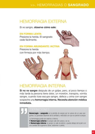 >>. HEMORRAGIAS O SANGRADO
67
Hemorragia externa
Si ve sangre, observe cómo sale:
EN FORMA LENTA
Presione la herida. El sangrado
cede fácilmente.
EN FORMA ABUNDANTE /ACTIVA
Presione la herida
con firmeza por más tiempo.
Hemorragia interna
Si no ve sangre después de un golpe, pero, al poco tiempo o
más tarde la persona tiene dolor, un moretón, transpira, vomita
sangre, cuando tose escupe sangre, defeca u orina con sangre
sospeche una hemorragia interna. Necesita atención médica
inmediata.
.DEFINICIONES
Hemorragia o sangrado es la pérdida de sangre por la ruptura de un vaso san-
guíneo. Su gravedad depende de la cantidad y velocidad con que se pierde la sangre.
La hemorragia puede ser externa o interna:
• Hemorragia externa: la sangre sale del cuerpo y se ve.
• Hemorragia interna: la sangre no sale al exterior y queda debajo de la piel o en
una cavidad del organismo (tórax, abdomen o pelvis).
 