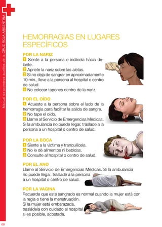 ManualdeprimerosauxiliosdelaCRUZROJAARGENTINA
68
Hemorragias en lugares
específicos
Por la nariz
1 Siente a la persona e inclínela hacia de-
lante.
2 Apriete la nariz sobre las aletas.
3 Si no deja de sangrar en aproximadamente
10 min., lleve a la persona al hospital o centro
de salud.
4 No colocar tapones dentro de la nariz.
Por el oído
1 Acueste a la persona sobre el lado de la
hemorragia para facilitar la salida de sangre.
2 No tape el oído.
3 Llame al Servicio de Emergencias Médicas.
Si la ambulancia no puede llegar, traslade a la
persona a un hospital o centro de salud.
Por la boca
1 Siente a la víctima y tranquilícela.
2 No le dé alimentos ni bebidas.
3 Consulte al hospital o centro de salud.
Por la vagina
Recuerde que este sangrado es normal cuando la mujer está con
la regla o tiene la menstruación.
Si la mujer está embarazada,
trasládela con cuidado al hospital
si es posible, acostada.
Por el ano
Llame al Servicio de Emergencias Médicas. Si la ambulancia
no puede llegar, traslade a la persona
a un hospital o centro de salud.
 