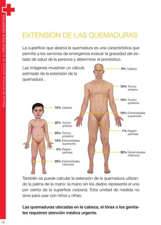 ManualdeprimerosauxiliosdelaCRUZROJAARGENTINA
74
ManualdeprimerosauxiliosdelaCRUZROJAARGENTINA
74
Extensión de las quemaduras
La superficie que abarca la quemadura es una característica que
permite a los servicios de emergencia evaluar la gravedad del es-
tado de salud de la persona y determinar el pronóstico.
Las imágenes muestran un cálculo
estimado de la extensión de la
quemadura .
También se puede calcular la extensión de la quemadura utilizan-
do la palma de la mano: la mano sin los dedos representa el uno
por ciento de la superficie corporal. Esta unidad de medida no
sirve para usar con niños y niñas.
Las quemaduras ubicadas en la cabeza, el tórax o los genita-
les requieren atención médica urgente.
16% Cabeza
9% Cabeza
20% Tronco
anterior
18% Tronco
anterior
20% Tronco
posterior
18% Tronco
posterior
0% Región
perineal
1% Región
perineal
16% Extremidades
superiores
18% Extremidades
superiores
28% Extremidades
inferiores
36% Extremidades
inferiores
 