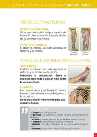 79
>>. LESIONES ÓSEAS, ARTICULARES Y MUSCULARES
TIPOS DE FRACTURAS
FRACTURA EXPUESTA
Se ve una herida de la piel por la salida del
hueso. El dolor es intenso. La parte afecta-
da se deforma y se hincha.
FRACTURA CERRADA
El dolor es intenso. La parte afectada se
deforma y se hincha.
torcedura
El dolor es intenso. La parte afectada se
deforma y se hincha la articulación.
Inmovilice la articulación. Eleve el
miembro lesionado y aplicar hielo sobre
la zona afectada.
Luxación
Las características y la intervención en una
luxación son similares a las del esguince o
la torcedura.
No realice ningún movimiento para aco-
modar el hueso.
.DEFINICIONES
Una fractura es la rotura de un hueso.
Una torcedura es el estiramiento o la torsión violenta de los ligamentos de una
articulación.
La luxación es una lesión grave en la que una articulacion sale fuera de su lugar.
Hay distensión cuando un músculo es estirado o se desgarra.
La contusión es un golpe en el músculo que produce una pequeña pérdida de
sangre.
Un calambre es una contracción dolorosa e involuntaria de un músculo.
Fractura
expuesta
Fractura
cerrada
TIPOS DE LESIONES ARTICULARES
 