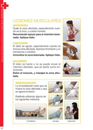 ManualdeprimerosauxiliosdelaCRUZROJAARGENTINA
80
ManualdeprimerosauxiliosdelaCRUZROJAARGENTINA
80
Lesiones musculares
Distensión
Duele la zona afectada, especialmente cuan-
do se la toca, y cuesta moverla.
Recomiende reposo para el miembro lesio-
nado. Aplique hielo.
Contusión
El dolor es agudo, especialmente cuando se
toca la zona afectada. Aparece hinchazón y un
hematoma o moretón.
Inmovilice la zona lesionada. Aplique hielo.
Calambre
El dolor es fuerte y no se puede mover el
miembro afectado, que se siente como en-
durecido.
Estire el músculo, y masajee la zona afec-
tada.
Entablillado Vendaje Cabestrillo
Inmovilización
La inmovilización evita que se
mueva la zona afectada y que
se agrave la lesión.
Realícela utilizando alguno de
los siguientes métodos.
 