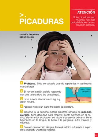 95
>.
PICADURAS
----------------------
ATENCIÓN
----------------------
Si las picaduras son
muchas, hay más
probabilidades de una
reacción alérgica.
1 Protéjase. Evite ser picado usando repelentes y vestimenta
manga larga.
2 Si hay un aguijón quítelo raspando
con una tarjeta dura (no use pinzas).
3 Lave la zona afectada con agua y
jabón neutro.
4 Aplique hielo o un paño frío sobre la picadura.
5 Observe si la persona picada presenta señales de reacción
alérgica: tiene dificultad para respirar; siente opresión en el pe-
cho; siente ardor o picazón en la piel y presenta urticaria; tiene
hinchazón en la lengua, la boca o la garganta; sufre mareos y
náuseas.
6 En caso de reacción alérgica, llame al médico o traslade a la per-
sona afectada urgente al hospital.
Una niña fue picada
por un insecto.
cómo quitar
el aguijon.
 