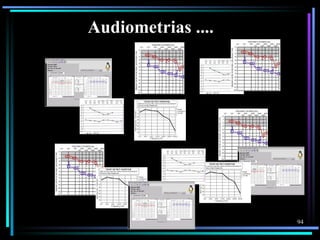 Audiometrias ....




                    94
 