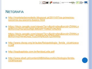NETGRAFIA
 http://marteladasnodedo.blogspot.pt/2011/07/os-primeiros-
socorros-ou-socorro-basico.html
 https://docs.google.com/viewer?a=v&pid=sites&srcid=ZXNhLn
B0fGVmZHxneDo3NjE3MDdlYTI0MzFmN2M3
https://docs.google.com/viewer?a=v&pid=sites&srcid=ZXNhLn
B0fGVmZHxneDozZTcyZWRjNDZkYjZiNWMy
 http://www.cbcsp.org.br/aulas/fisiopatologia_ferida_cicatrizaca
o.pdf
 http://bapbaptista.com.br/feridasLeila.pdf
 http://www.ebah.pt/content/ABAAAevmAAJ/biologia-ferida-
cicatrizacao
 