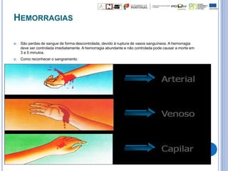 HEMORRAGIAS
 São perdas de sangue de forma descontrolada, devido à ruptura de vasos sanguíneos. A hemorragia
deve ser controlada imediatamente. A hemorragia abundante e não controlada pode causar a morte em
3 a 5 minutos.
 Como reconhecer o sangramento
 