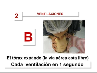 El tórax expande (la vía aérea esta libre)
Cada ventilación en 1 segundo
B
VENTILACIONES
2
 