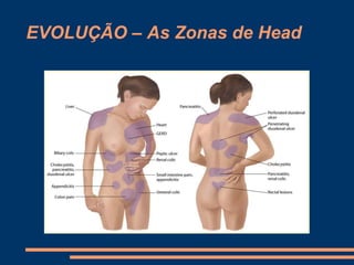 EVOLUÇÃO – As Zonas de Head
 