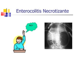.Enterocolitis Necrotizante- neonatología | PPT