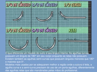 O que diferencia um modelo do outro é seu ângulo interno. As agulhas curvas
possuem um ângulo de 180° em seu corpo enquanto as retas não possuem.
Existem também as agulhas semi-curvas que possuem ângulos menores que 180°
e maiores que 0°.
Modelos mais usados por se adequarem melhor a região onde a sutura é feita, a
agulha curva e a semi-curva precisam do uso de um porta-agulhas, diferentemente
das agulhas retas que são manobradas pelas mãos do profissional.
 