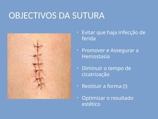 • Evitar que haja infecção de
ferida
• Promover e Assegurar a
Hemostasia
• Diminuir o tempo de
cicatrização
• Restituir a forma (!)
• Optimizar o resultado
estético
OBJECTIVOS DA SUTURA
 