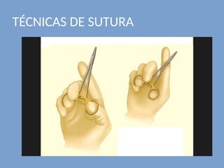 TÉCNICAS DE SUTURA
 