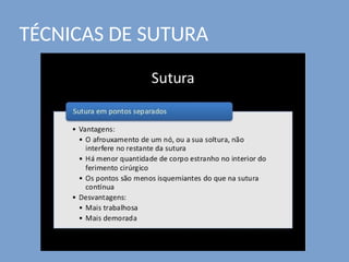 TÉCNICAS DE SUTURA
 