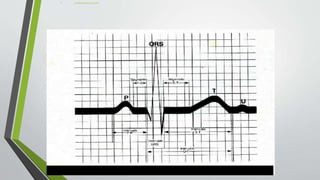 A. SISTEMATICA PARA SU LECTURA:
 