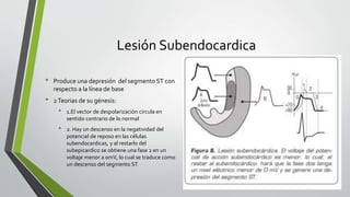Lesión Subendocardica
• Produce una depresión del segmento ST con
respecto a la línea de base
• 2Teorias de su génesis:
• 1.El vector de despolarización circula en
sentido contrario de lo normal
• 2. Hay un descenso en la negatividad del
potencial de reposo en las células
subendocardicas, y al restarlo del
subepicardico se obtiene una fase 2 en un
voltaje menor a 0mV, lo cual se traduce como
un descenso del segmento ST
 