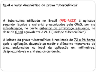 Curso tuberculose, hanseníase e sífilis novo | PDF