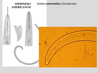 Estilete odontostílico (Dorylaimida)
 