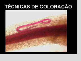 TÉCNICAS DE COLORAÇÃOTÉCNICAS DE COLORAÇÃO
 