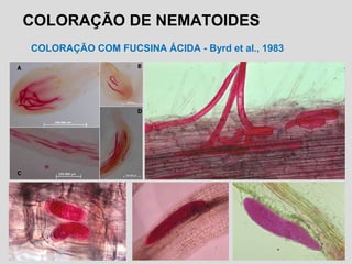 COLORAÇÃO DE NEMATOIDES
COLORAÇÃO COM FUCSINA ÁCIDA - Byrd et al., 1983
 