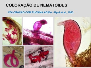 COLORAÇÃO DE NEMATOIDES
COLORAÇÃO COM FUCSINA ÁCIDA - Byrd et al., 1983
 