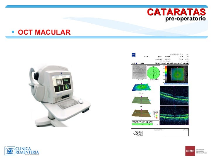 Cataratas - Dr. Rementeria | Universidad Internacional Menendez Pelayo