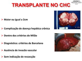 TRANSPLANTE NO CHC
 Maior ou igual a 2cm
 Sem indicação de ressecção
 Dentro dos critérios de Milão
 Complicação de doença hepática crônica
 Ausência de invasão vascular
 Diagnóstico: critérios de Barcelona
 