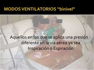 Menores requerimientos de sedación