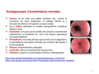 Endoscopia Normal Curso XII. Endoscopia digestiva superior.ppt