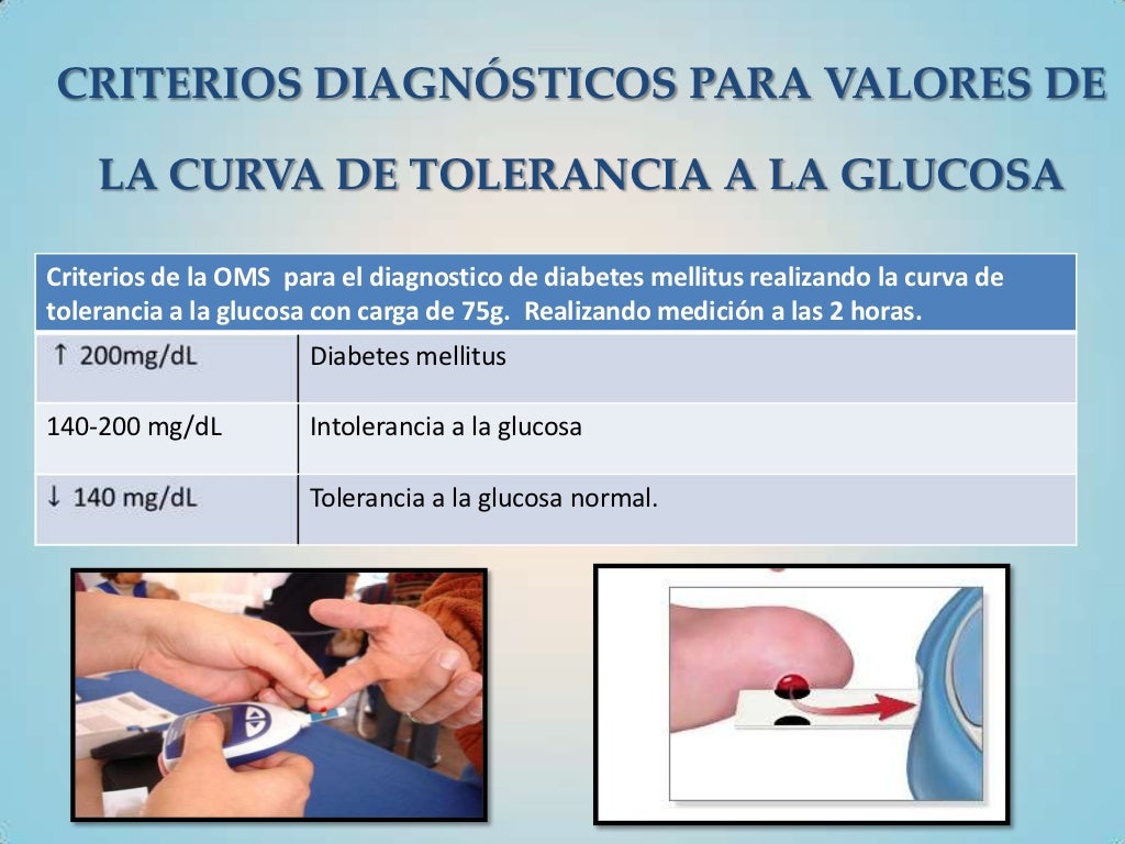 Curva de tolerancia a la glucosa
