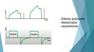 - Edema pulmonar
- Atelectasia
- neumotórax
 