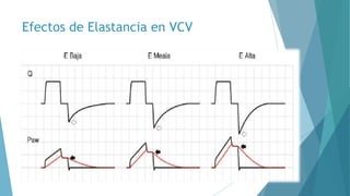 Efectos de Elastancia en VCV
 